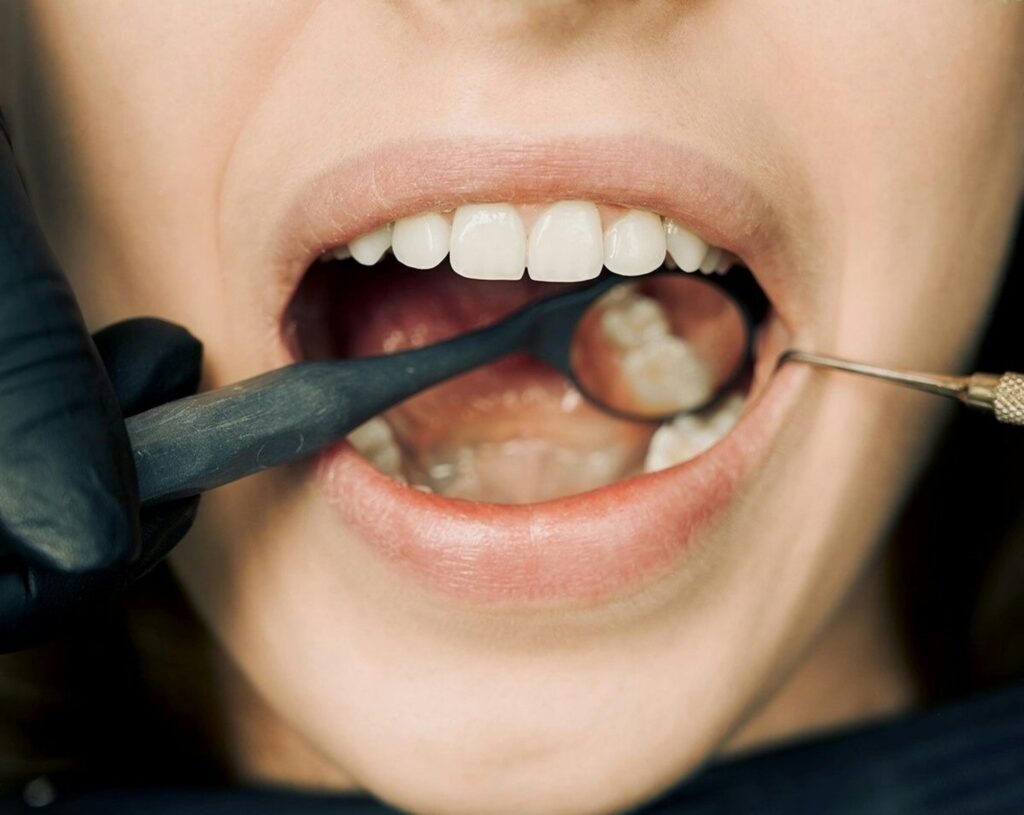 what is a root canal?