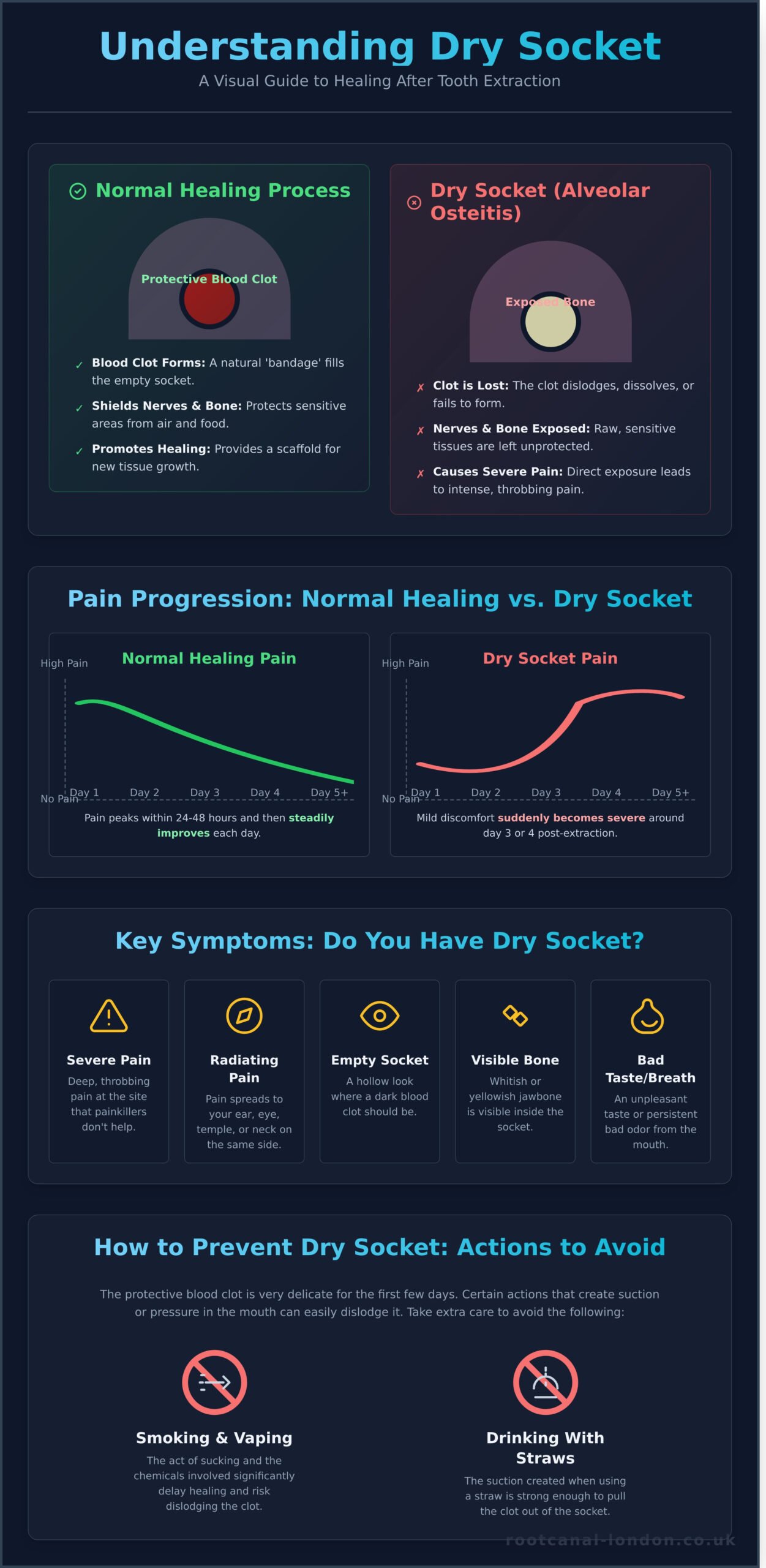 What Is Dry Socket? A Reassuring Guide to Symptoms, Causes, and Treatment - Infographic