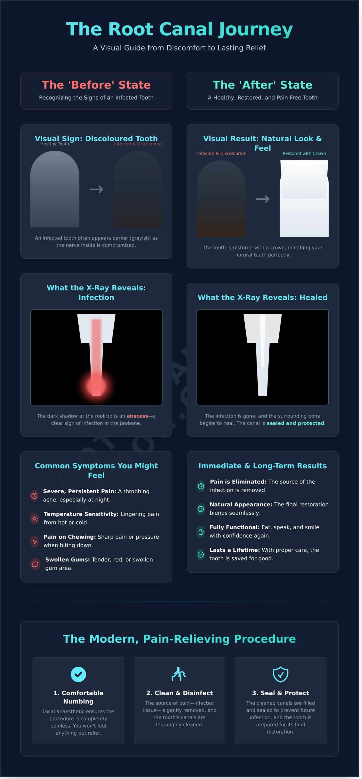 Root Canal Before and After: A Visual Guide to Your Treatment - Infographic